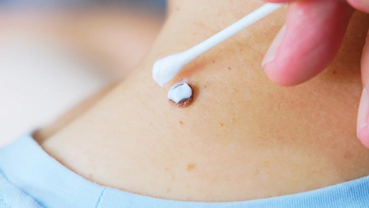 lazerle aldiran da var solusyon suren de her ben masum degil incelenmeli kQXZh9L2.jpg